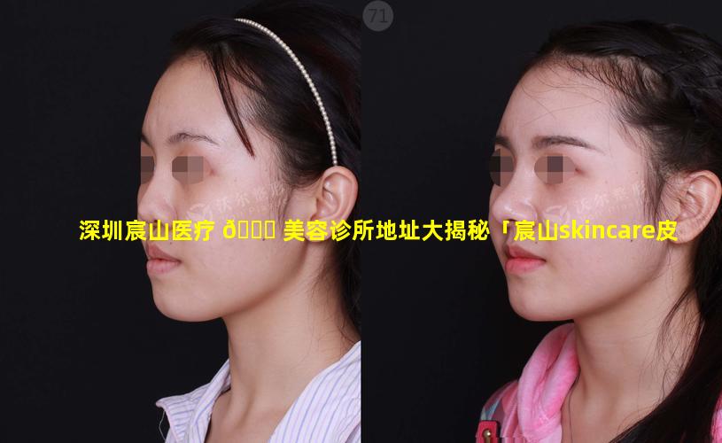 深圳宸山医疗 🍀 美容诊所地址大揭秘「宸山skincare皮肤管理中心」